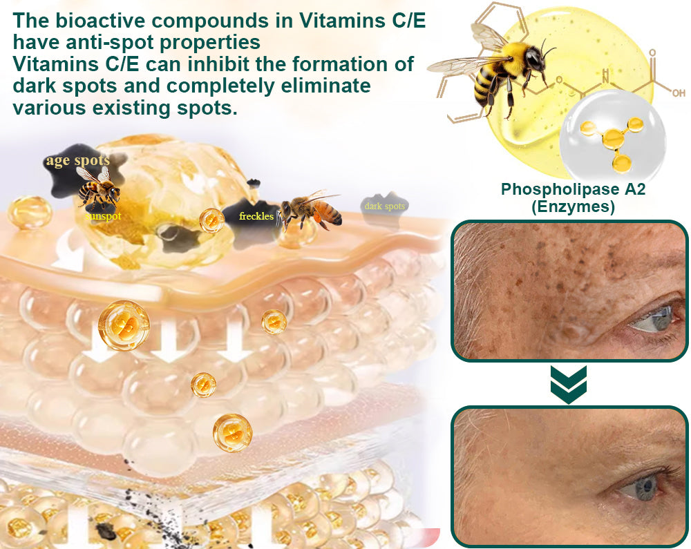 【Official Store】ODEIUN Multi-Symptom Bee Venom Relief Cream (AAD Recommended)👨‍⚕️⭐『Collagen loss, Acne, Eczema, Inflammation, Warts, Age spots, Skin scars』